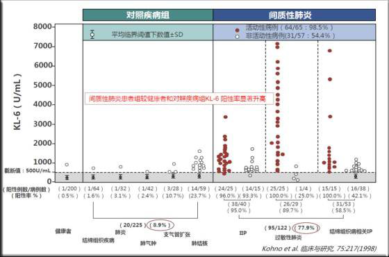 检测ILDs的全新血清生物标记物.jpg